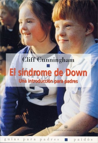 EL SINDROME DE DOWN