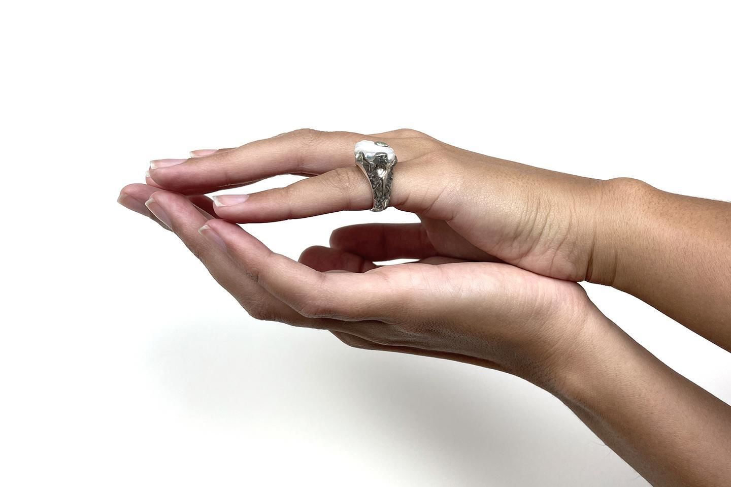 Anillo Erosión